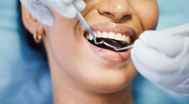 Best Teeth Whitening  in Essex Junction, VT