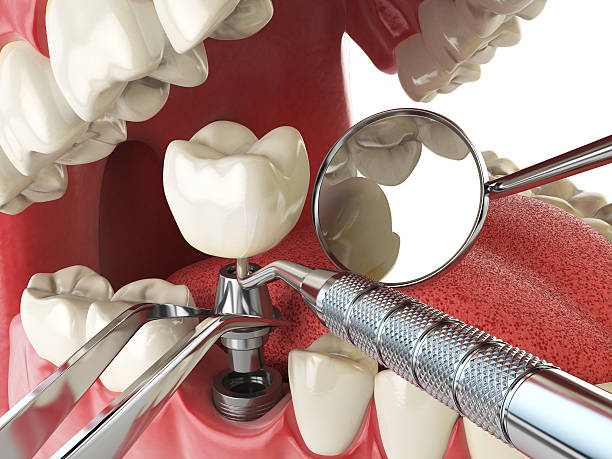 Best Emergency Dental Clinic in VT